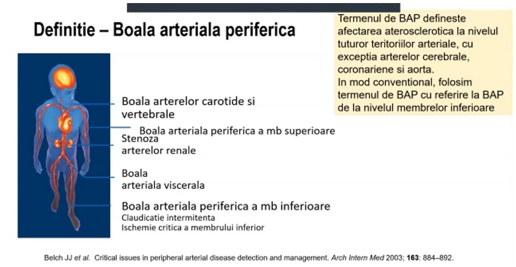 Boala arteriala periferica (BAP)