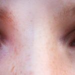 Evaluarea pacienților cu simptome sugestive pentru sindromul de ochi uscat