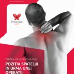 InfoPac: Poziția spatelui în urma unei operații