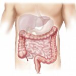 Rolul antibioticelor în apariția cancerului de colon