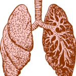 Repere de probabilitate pentru diagnosticul   bronhopneumopatiei cronice obstructive