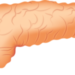 Simptome și semne frecvent întâlnite în cancerul de pancreas