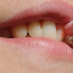 Impactul bolilor cavității bucale asupra sănătății creierului