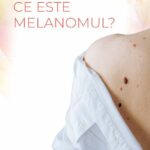 Melanomul