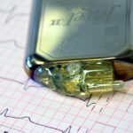 Ce este un pacemaker (stimulator cardiac)?