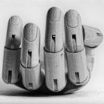 Sindromul de hiperlaxitate articulară