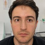 Anisocoria – orientare etiologică